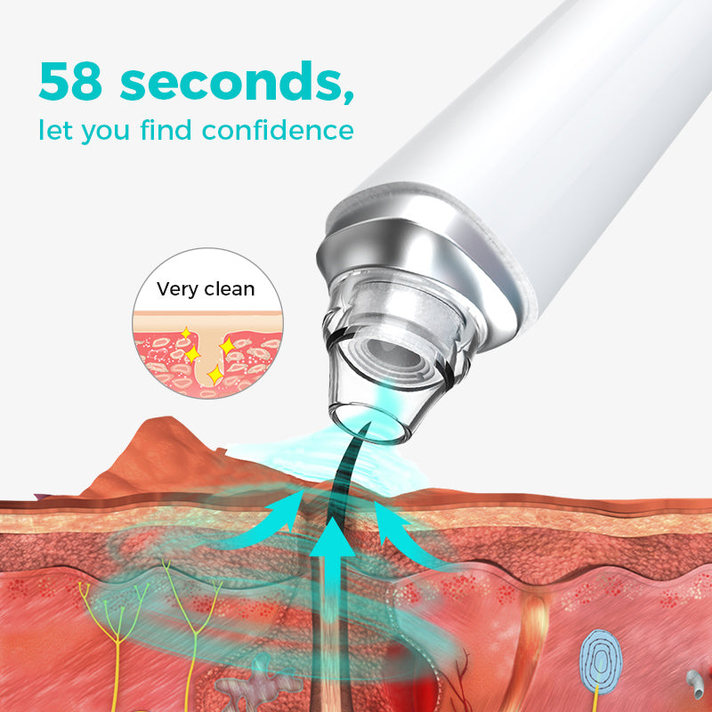blackhead remover with 20x magnification