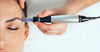 Microneedling Post-Care Tips for Optimal Results