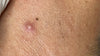 Why You’re Still Getting Ingrown Hairs After Shaving