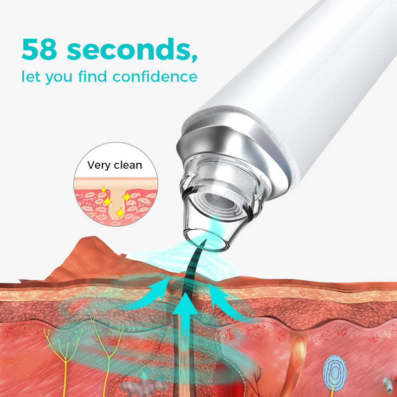 pore vacuum cleaner for blackheads and acne